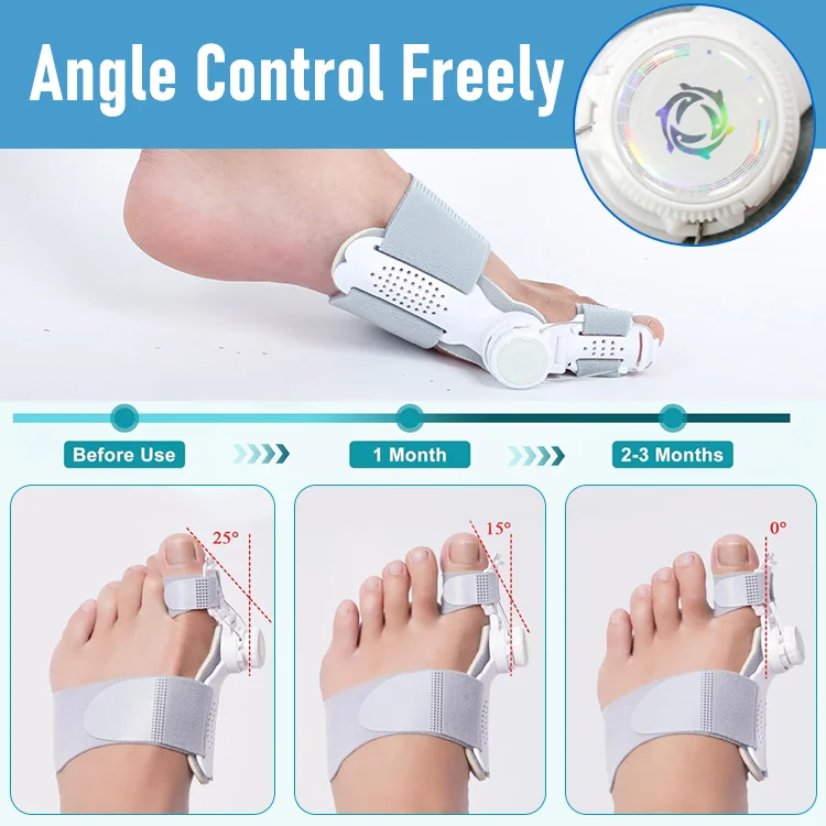 Eicgo Bunion Corrector for Women & Men - Image 2
